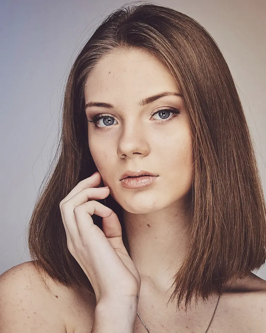 Before treatment — Precision Fractional Laser Resurfacing, illustrative comparison